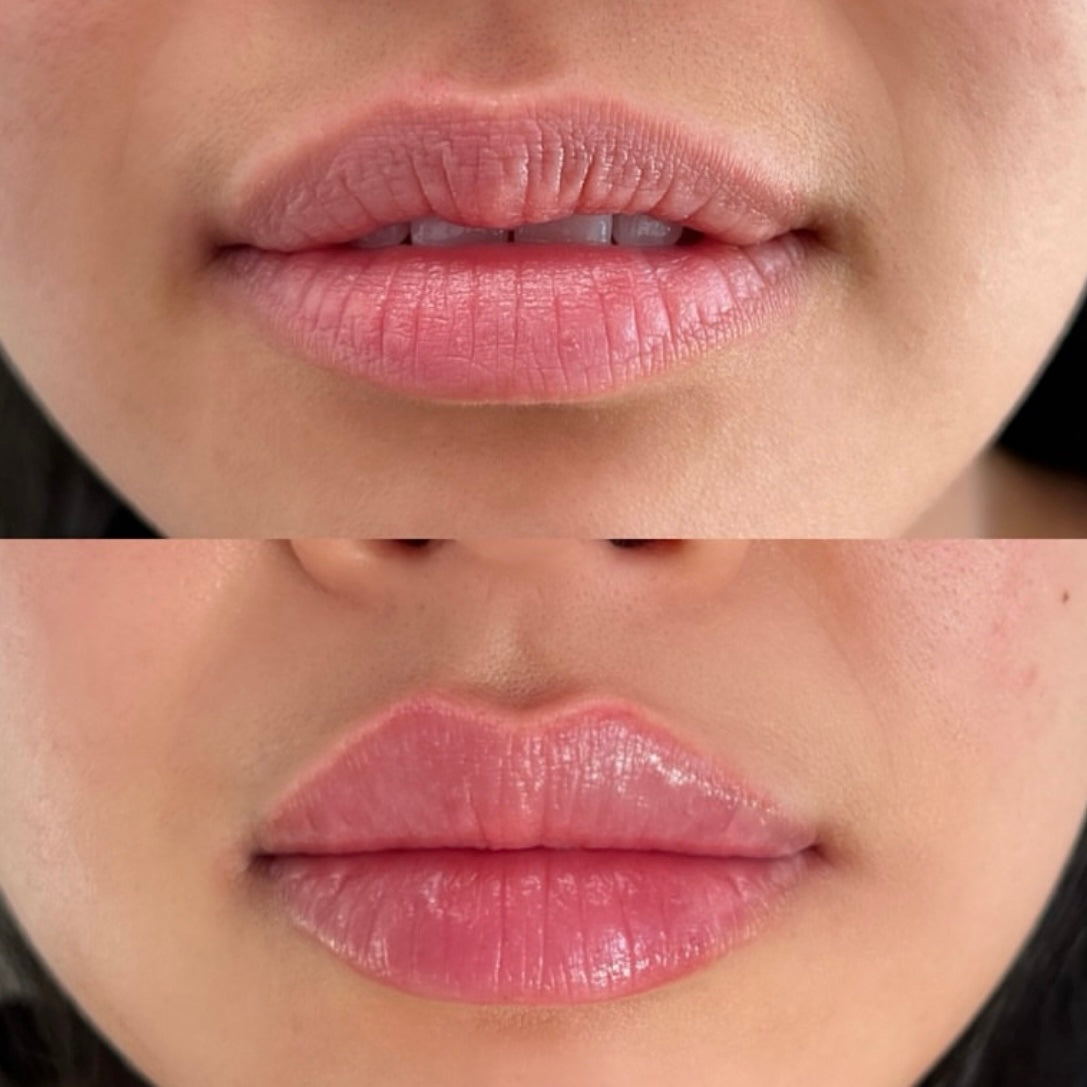 2X Volumizing Lip Plumper