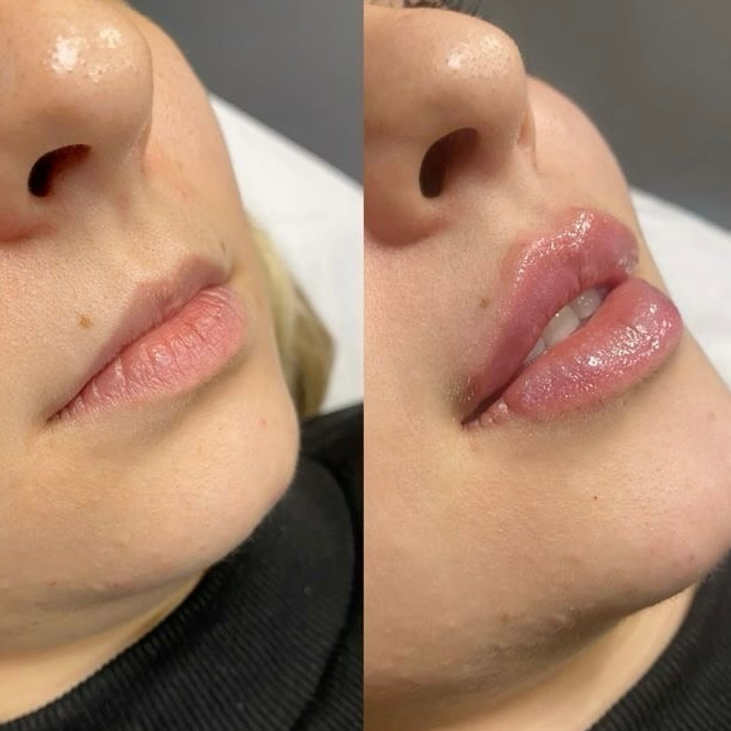 2X Volumizing Lip Plumper