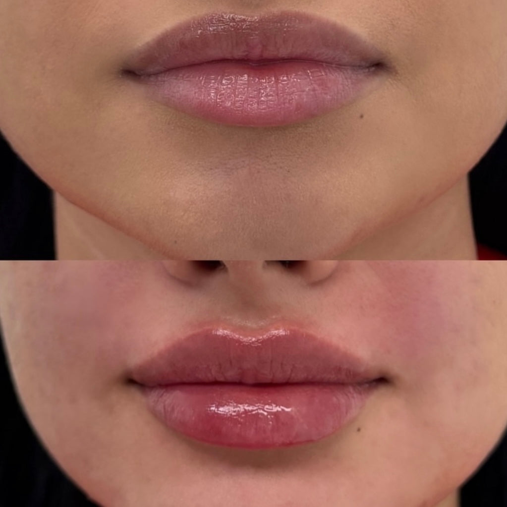 2X Volumizing Lip Plumper