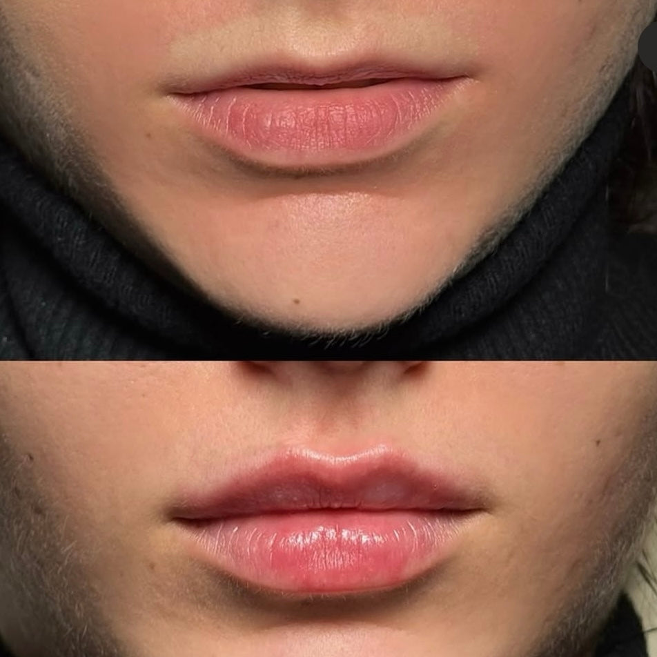 2X Volumizing Lip Plumper