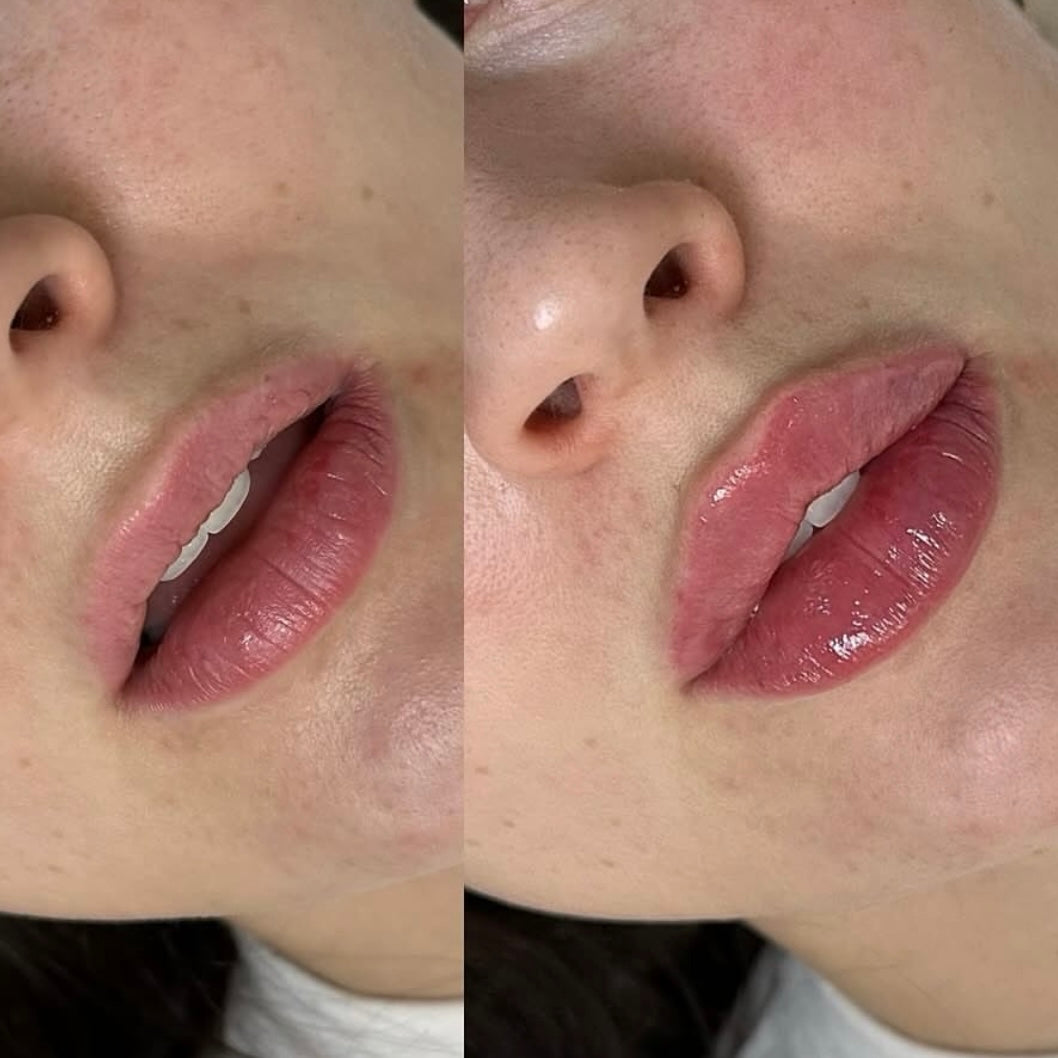 2X Volumizing Lip Plumper